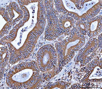 VAPA Rabbit Polyclonal Antibody