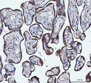 VAPA Rabbit Polyclonal Antibody