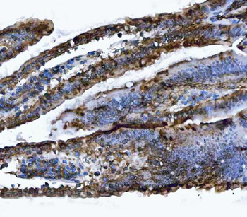 VAPA Rabbit Polyclonal Antibody
