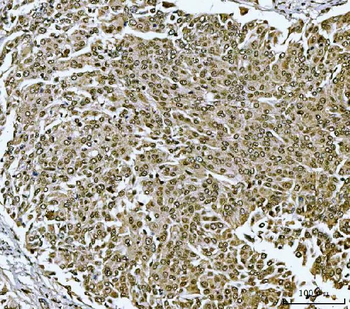 TWIST1/2 Rabbit Polyclonal Antibody