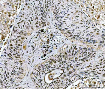 TWIST1/2 Rabbit Polyclonal Antibody