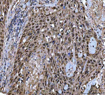 TWIST1/2 Rabbit Polyclonal Antibody