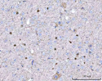 TWIST1/2 Rabbit Polyclonal Antibody