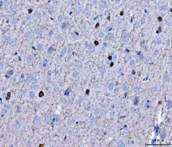 TWIST1/2 Rabbit Polyclonal Antibody