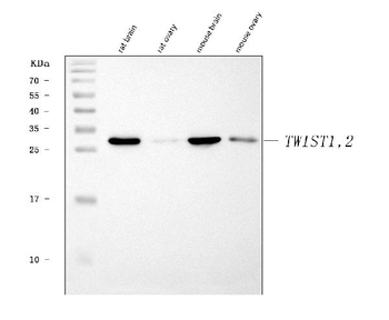 TWIST1/2 Rabbit Polyclonal Antibody
