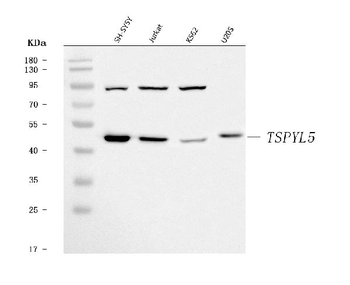 TSPYL5 Rabbit Polyclonal Antibody