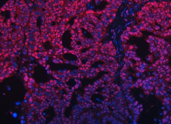 TRMT10C Rabbit Polyclonal Antibody