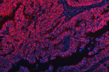 TRMT10C Rabbit Polyclonal Antibody
