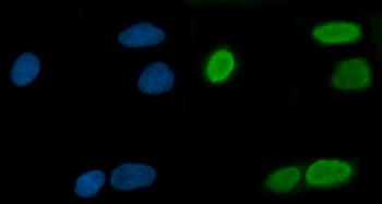 TRMT10C Rabbit Polyclonal Antibody