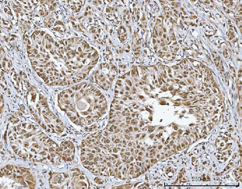 TRMT10C Rabbit Polyclonal Antibody