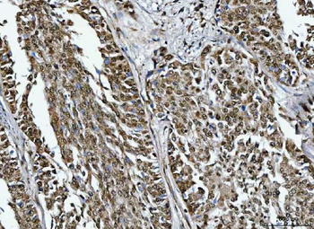 TRMT10C Rabbit Polyclonal Antibody