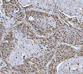 TRMT10C Rabbit Polyclonal Antibody