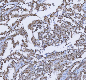 TRMT6 Rabbit Polyclonal Antibody