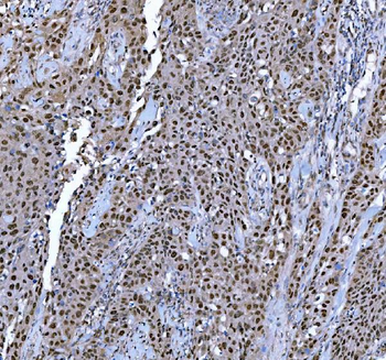 TRMT6 Rabbit Polyclonal Antibody