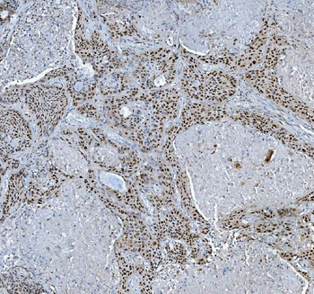 TRMT6 Rabbit Polyclonal Antibody