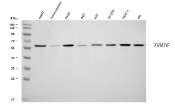 TRMT6 Rabbit Polyclonal Antibody