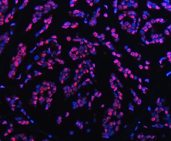 TRMT6 Rabbit Polyclonal Antibody