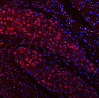 TRMT6 Rabbit Polyclonal Antibody
