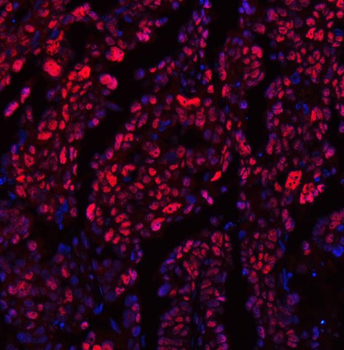 TRMT6 Rabbit Polyclonal Antibody