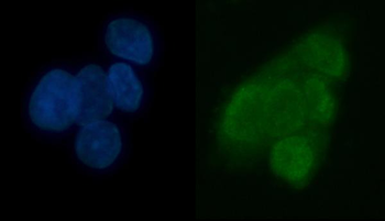 TRMT6 Rabbit Polyclonal Antibody