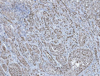 TRMT6 Rabbit Polyclonal Antibody
