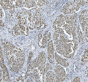 TRMT6 Rabbit Polyclonal Antibody