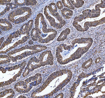 TRMT6 Rabbit Polyclonal Antibody