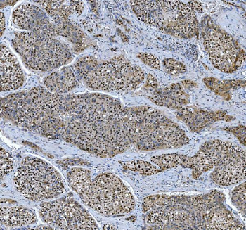 TRMT6 Rabbit Polyclonal Antibody