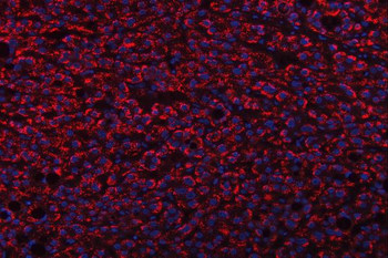 TRANK1 Rabbit Polyclonal Antibody