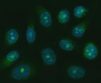 TRANK1 Rabbit Polyclonal Antibody