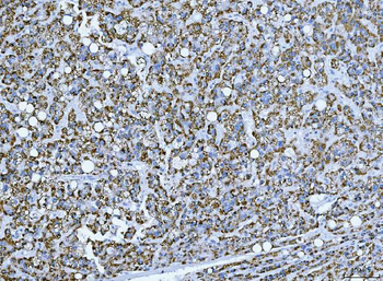 TRANK1 Rabbit Polyclonal Antibody