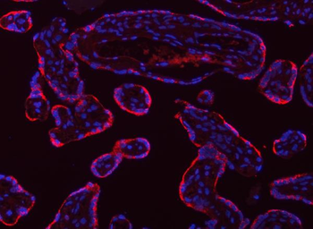Tropomyosin 2/TPM2 Rabbit Polyclonal Antibody