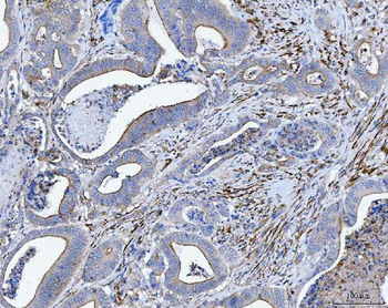 Tropomyosin 2/TPM2 Rabbit Polyclonal Antibody