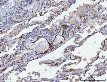 Tropomyosin 2/TPM2 Rabbit Polyclonal Antibody