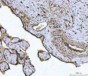 Tropomyosin 2/TPM2 Rabbit Polyclonal Antibody