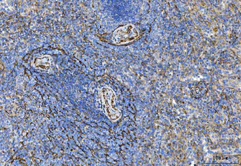 Tropomyosin 2/TPM2 Rabbit Polyclonal Antibody