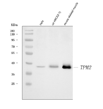 Tropomyosin 2/TPM2 Rabbit Polyclonal Antibody