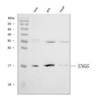 gamma Synuclein/SNCG Rabbit Polyclonal Antibody