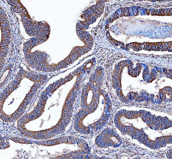 Kindlin 2/FERMT2 Rabbit Polyclonal Antibody