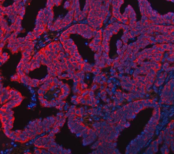 FADS1 Rabbit Polyclonal Antibody