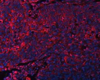 DOCK180/DOCK1 Rabbit Polyclonal Antibody