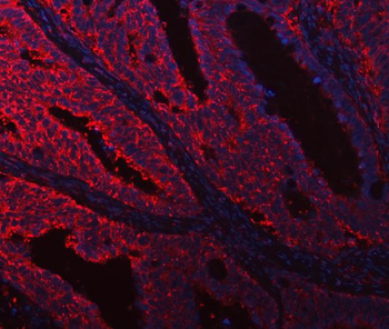 DOCK180/DOCK1 Rabbit Polyclonal Antibody
