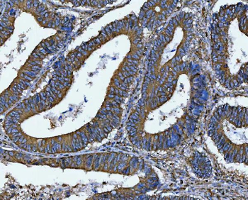 DOCK180/DOCK1 Rabbit Polyclonal Antibody