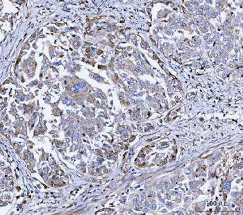 DOCK180/DOCK1 Rabbit Polyclonal Antibody