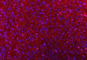CNPase/CNP Rabbit Polyclonal Antibody