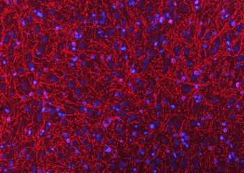 CNPase/CNP Rabbit Polyclonal Antibody