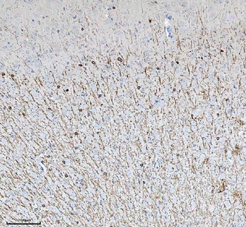 CNPase/CNP Rabbit Polyclonal Antibody