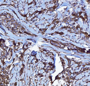 GPCR RDC1/CXCR-7/ACKR3/CXCR Rabbit Polyclonal Antibody
