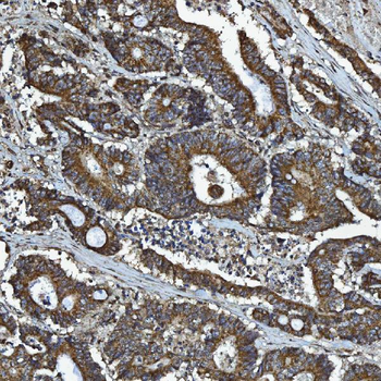 GPCR RDC1/CXCR-7/ACKR3/CXCR Rabbit Polyclonal Antibody