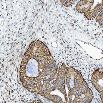 GPCR RDC1/CXCR-7/ACKR3/CXCR Rabbit Polyclonal Antibody